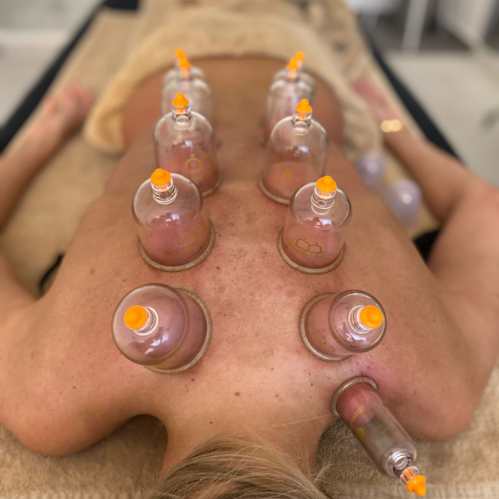 Baňkování fotka